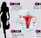 THUỐC ĐIỀU TRỊ SUY BUỒNG TRỨNG SỚM 
