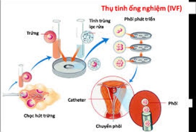 THUỐC HỖ TRỢ CHUYỂN PHÔI ĐÔNG Y