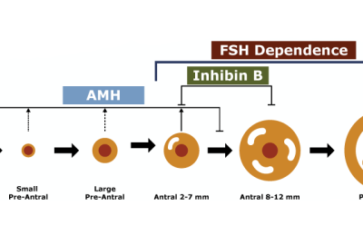  VÌ SAO BẠN PHẢI XÉT NGHIỆM FSH KHI AMH THẤP